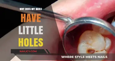 Why Do My Nails Have Little Holes? Causes and Solutions