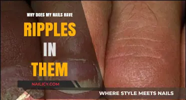 Ripples in Your Nails: Causes, Concerns, and Solutions Explained