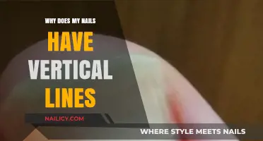 Vertical Lines on Nails: Causes, Concerns, and When to Seek Help