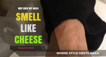 Why Do My Nails Smell Like Cheese? Causes and Solutions