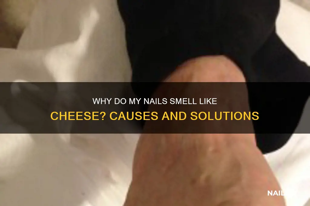 why does my nails smell like cheese