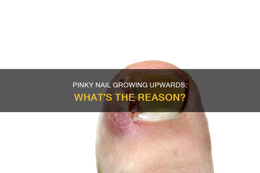 why does my pinky nail grow upwards