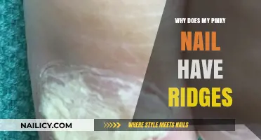 Why Does My Pinky Nail Have Ridges? Causes and Solutions