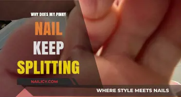 Why Your Pinky Nail Splits: Causes and Solutions Explained