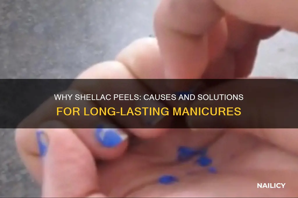 why does my shellac nail polish peel off