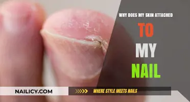 Why Does My Skin Attach to My Nail? Causes and Solutions