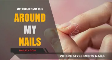 Why Skin Peels Around Nails: Causes, Remedies, and Prevention Tips