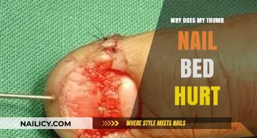 Why Does My Thumb Nail Bed Hurt? Causes and Remedies Explained