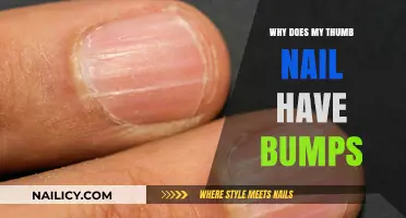 Why Do Thumb Nails Develop Bumps? Causes and Solutions Explained