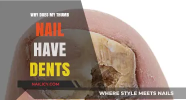 Thumb Nail Dents Explained: Causes and Solutions for Ridged Nails