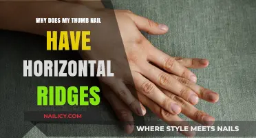 Why Horizontal Ridges Appear on Your Thumb Nail: Causes Explained