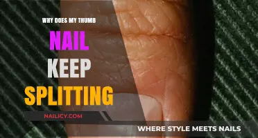 Why Does My Thumb Nail Keep Splitting? Causes and Solutions