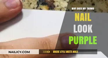 Why Your Thumb Nail Looks Purple: Causes and Solutions Explained