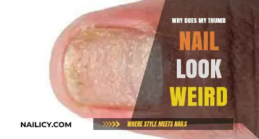 Why Does My Thumb Nail Look Weird? Causes and Solutions