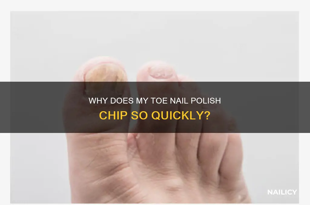 why does my toe nail polish chip