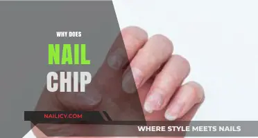 Why Do Nails Chip? Causes, Prevention, and Long-Lasting Solutions