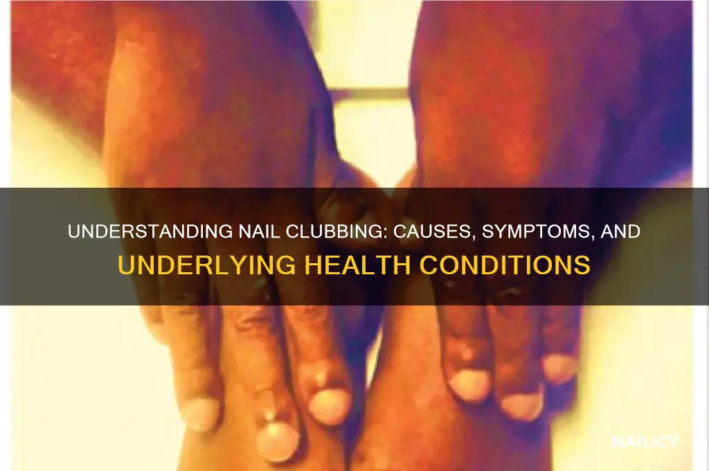 why does nail clubbing happen