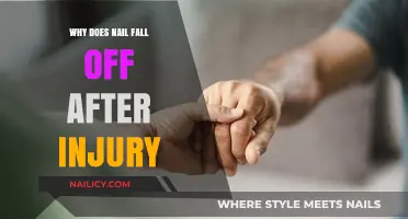 Why Nails Fall Off After Injury: Causes and Recovery Explained