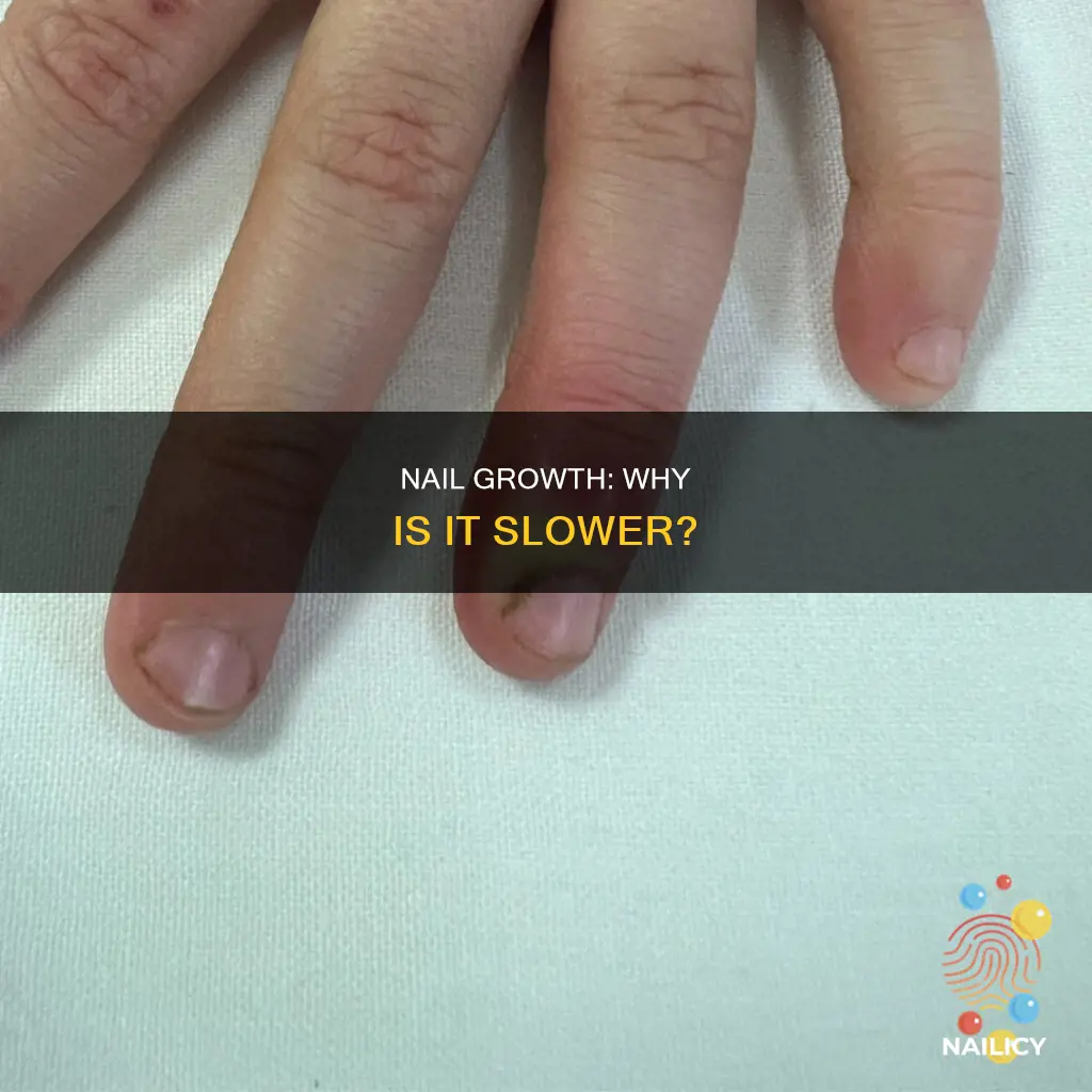 why does nail grow slower than rest