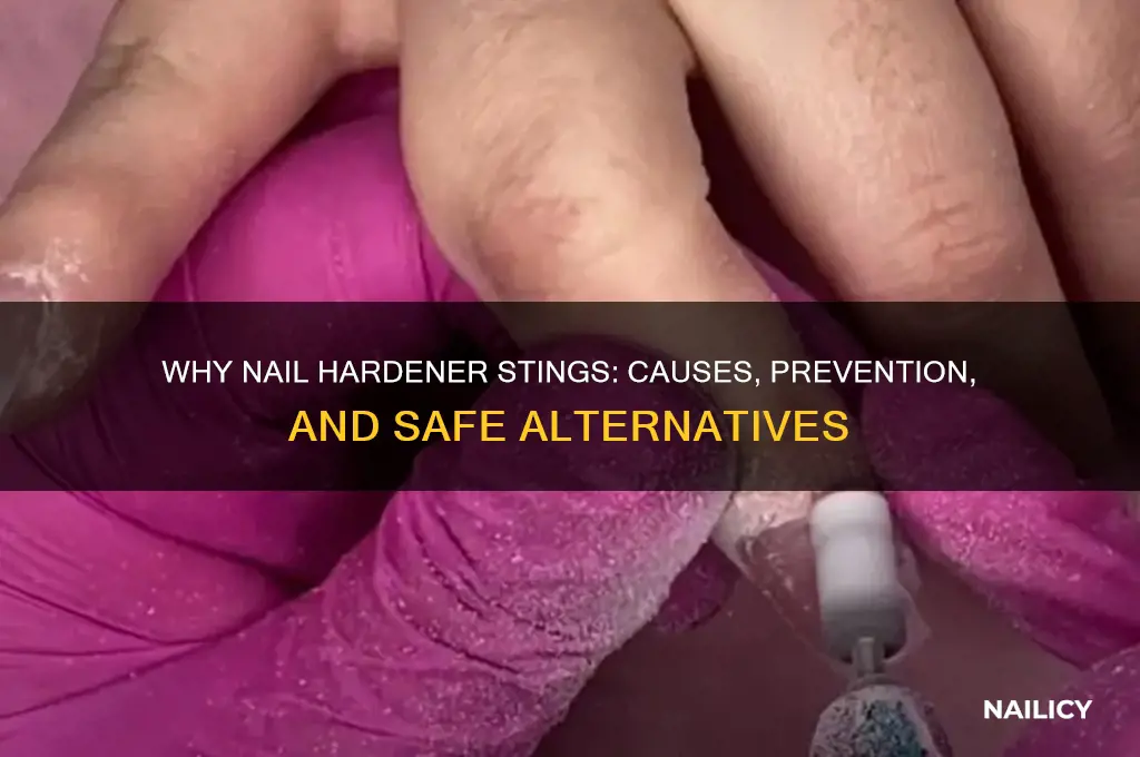 why does nail hardener sting