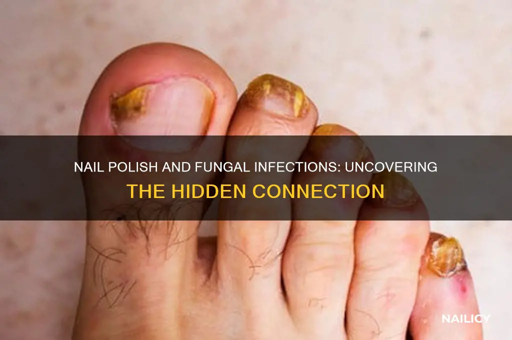 why does nail polish cause fungus
