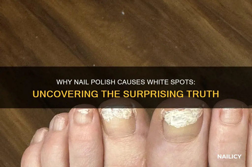 why does nail polish cause white spots