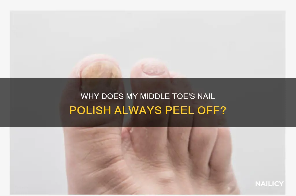 why does nail polish come off my middle toe only