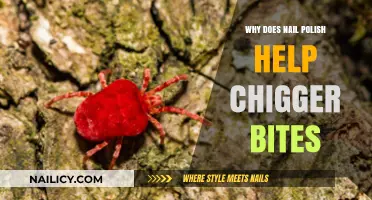 Nail Polish for Chigger Bites: A Surprising Itch Relief Hack