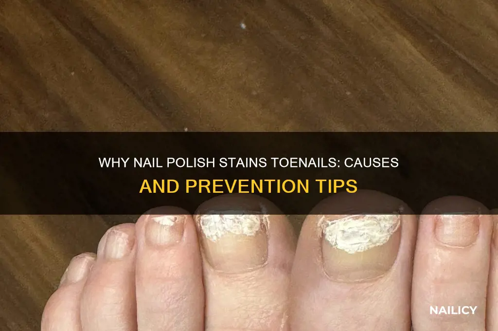 why does nail polish stain my tornails