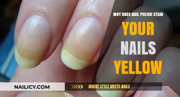 Why Nail Polish Turns Nails Yellow: Causes and Prevention Tips