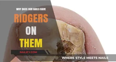 Why Do Nails Develop Ridges? Causes and Concerns Explained