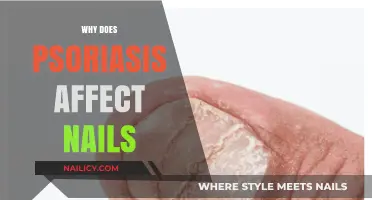 Understanding Psoriasis: How and Why It Impacts Your Nails