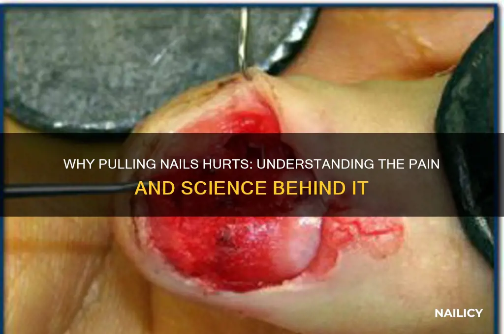 why does pulling nails hurt