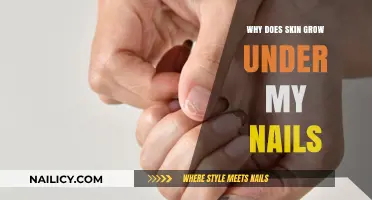 How Skin Grows Under Nails: Causes and Prevention