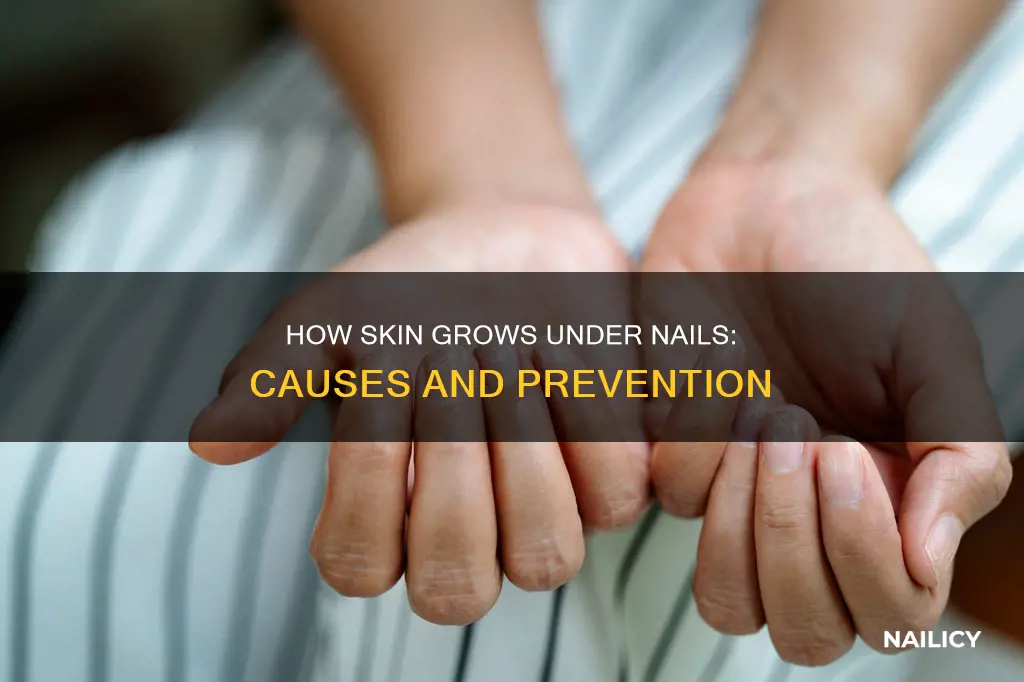 why does skin grow under my nails