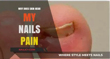Why Does Skin Near My Nails Hurt? Causes and Remedies