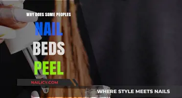 Why Do Some People's Nail Beds Peel? Causes and Solutions