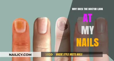 Why Doctors Examine Your Nails: Uncovering Hidden Health Clues