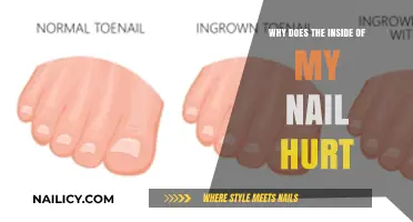 Why Does the Inside of My Nail Hurt? Causes and Remedies