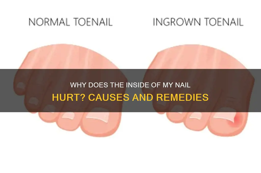 why does the inside of my nail hurt