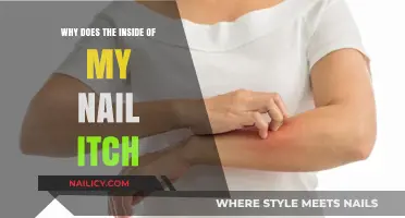 Why Does the Inside of My Nail Itch? Causes and Remedies