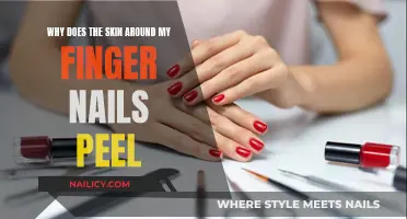 Unraveling the Mystery: Why Your Nails' Skin Peels Away