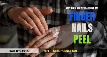 How to Stop Skin Peeling Around Fingernails