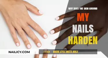 Why Does Skin Around Nails Harden? Causes and Solutions Explained