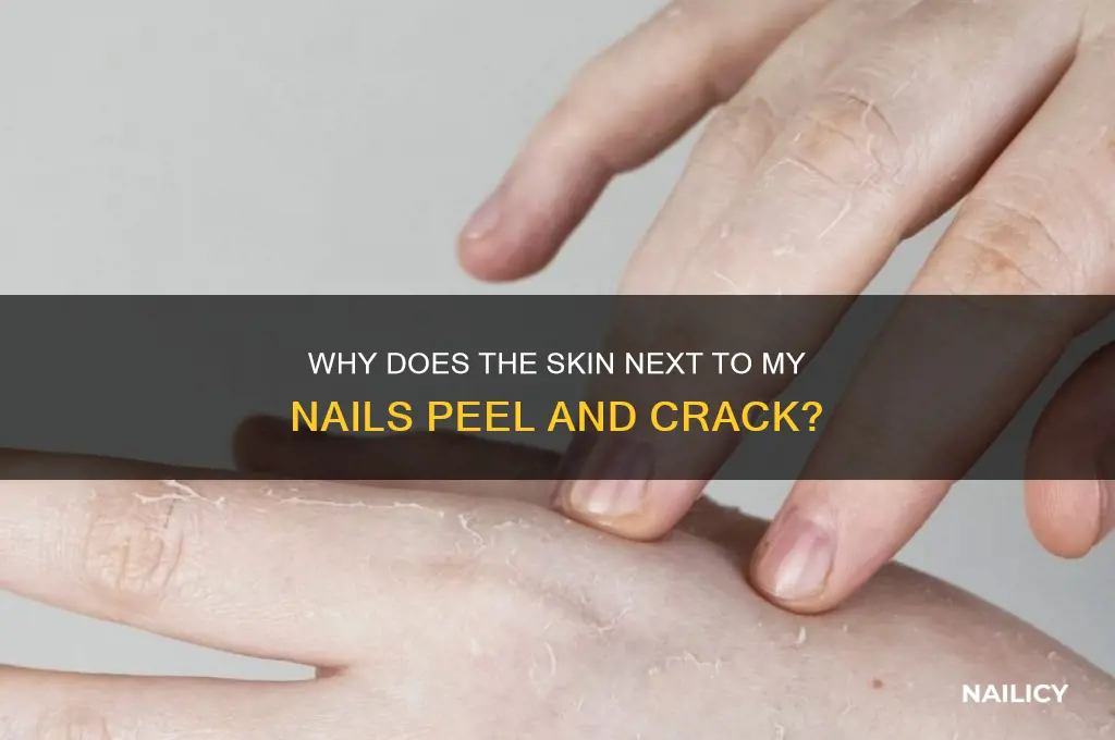 why does the skin next to my nails