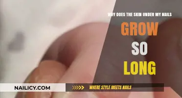 How to Stop Nails From Growing Skin Underneath