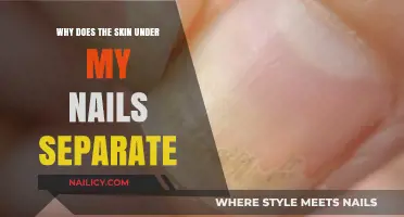 Why Does Skin Under Nails Separate? Causes and Solutions