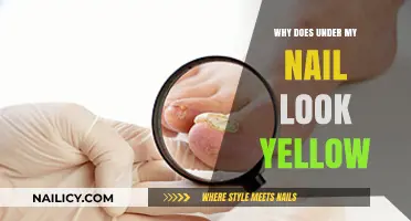 Why Your Nail Bed Turns Yellow: Causes and Solutions Explained