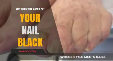 Why Vick Vaporub Causes Nail Discoloration: Uncovering the Black Truth
