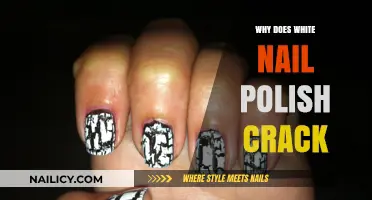 Why White Nail Polish Cracks: Causes and Prevention Tips